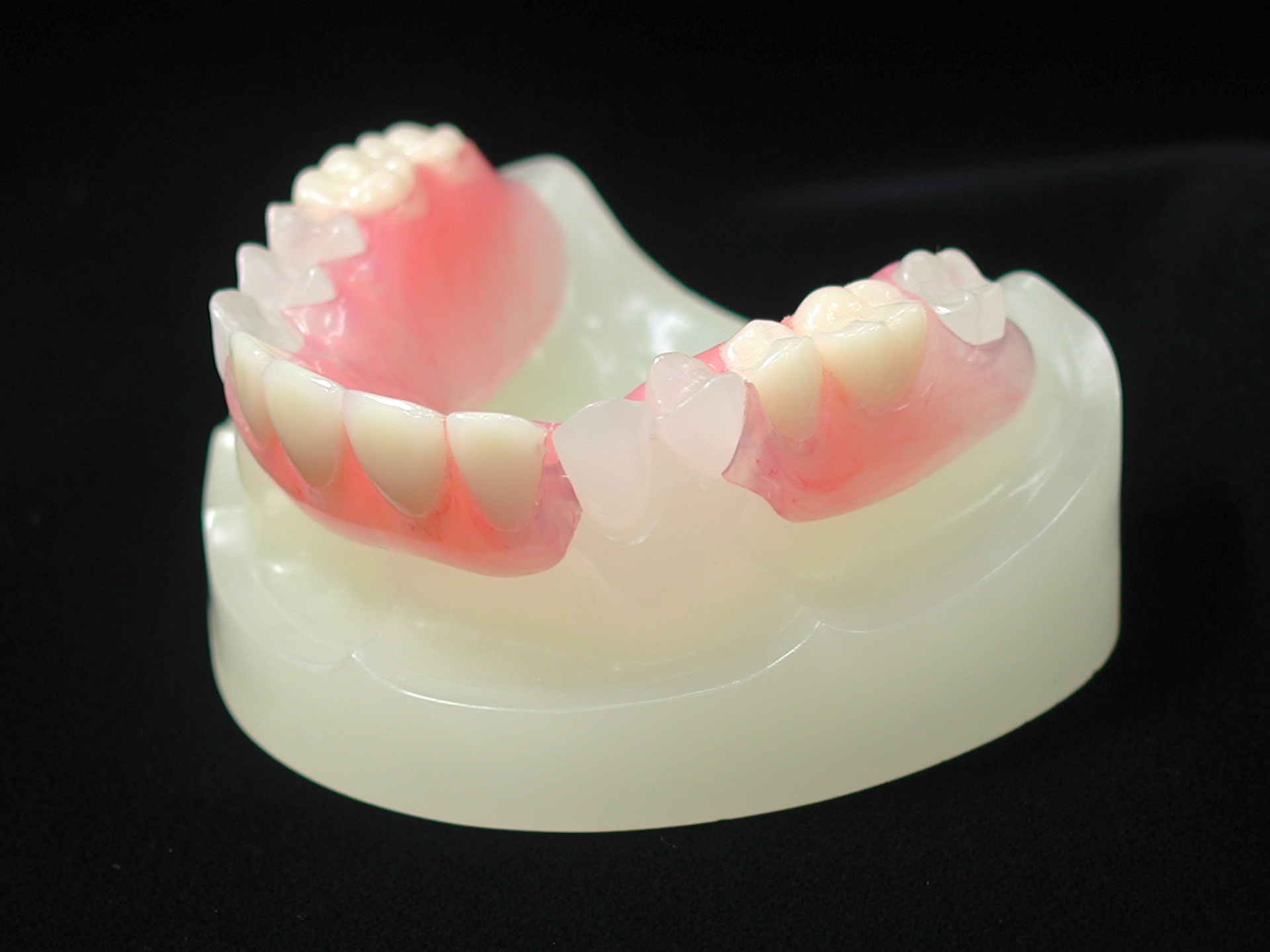 なぜ入れ歯治療が必要なのか