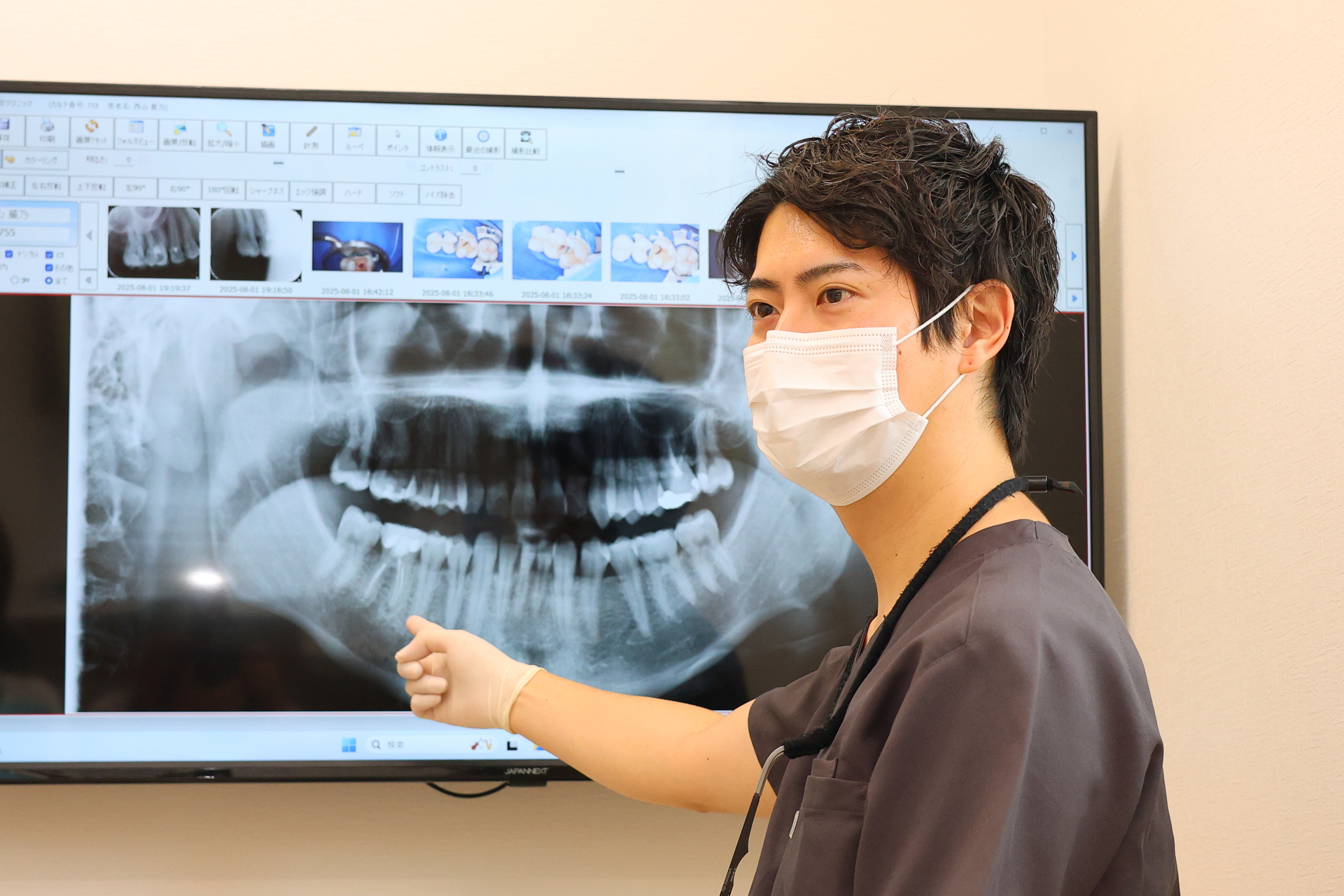 歯の表面の準備(下地処理)
