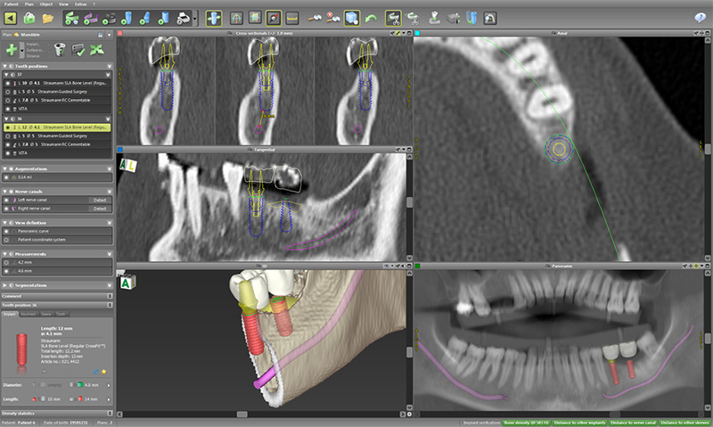 シミュレーション