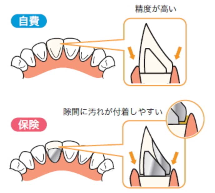 高い適合精度